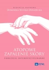 Atopowe zapalenie skóry. Podejście interdyscyplinarne - zdjęcie