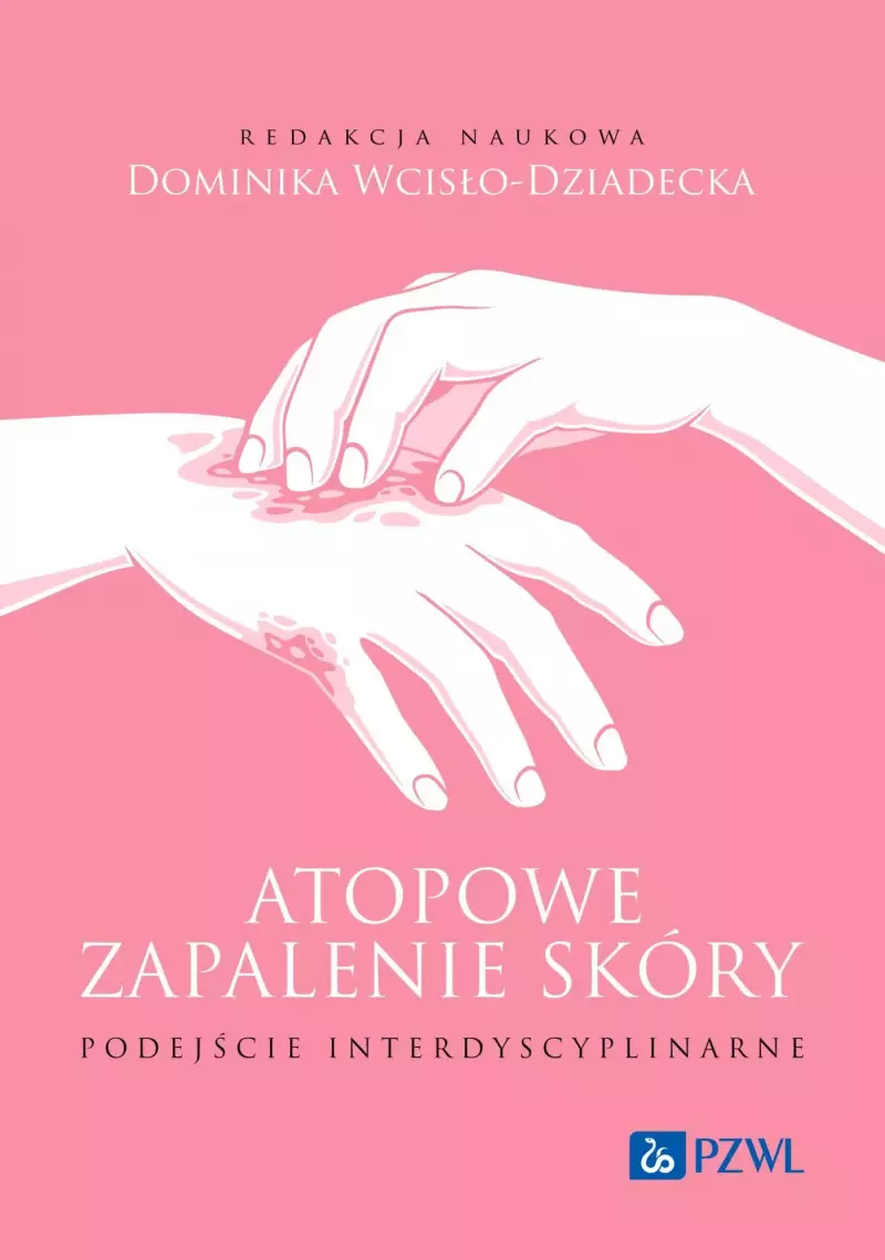 Atopowe zapalenie skóry. Podejście interdyscyplinarne Atopowe zapalenie skóry. Podejście interdyscyplinarne