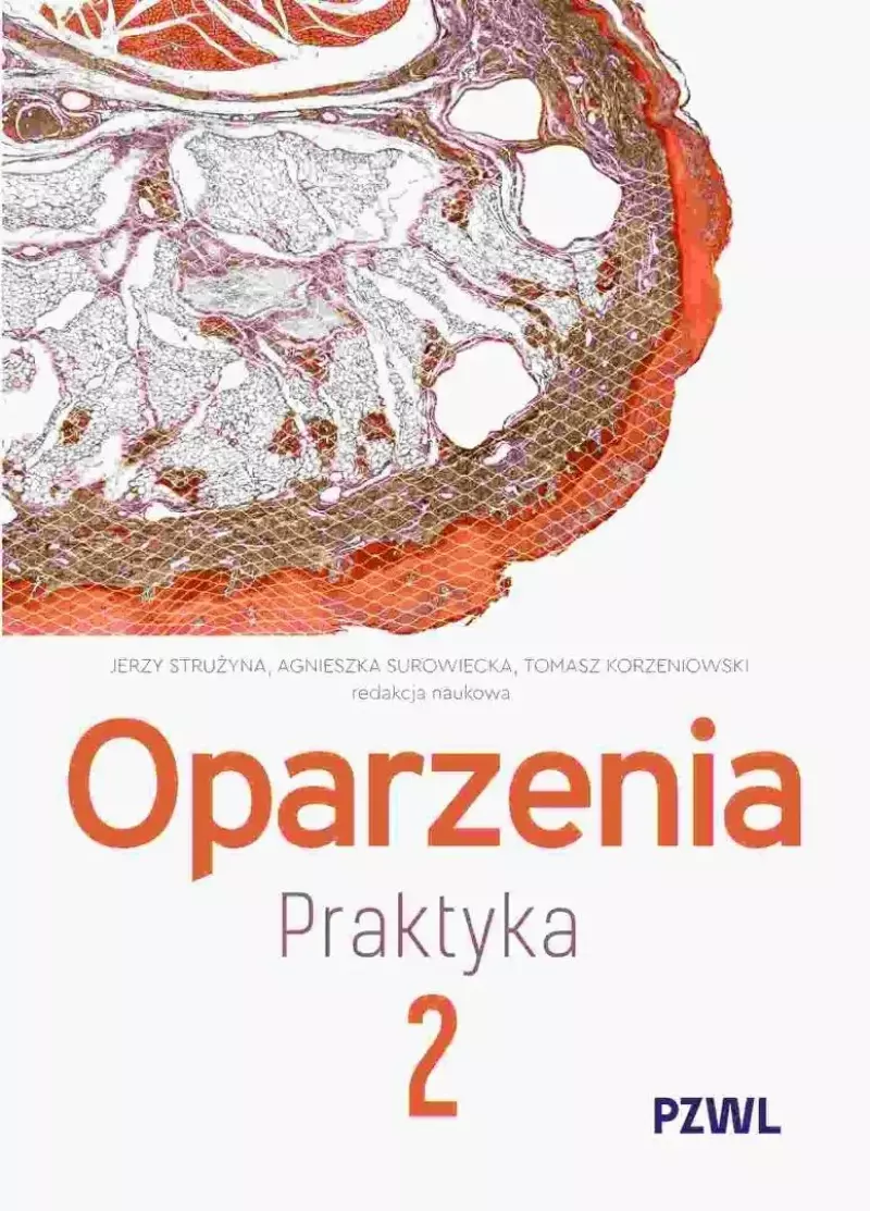Oparzenia. Praktyka T.2 Oparzenia. Praktyka T.2