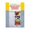 Nowotwory narządu wzroku - zdjęcie