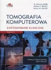 Tomografia komputerowa. Zastosowanie kliniczne - zdjęcie