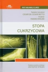 Stopa cukrzycowa - zdjęcie