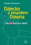 Dziecko z zespołem Downa - zdjęcie