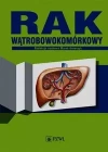 Rak wątrobowokomórkowy - zdjęcie