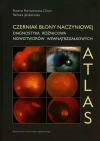 Czerniak błony naczyniowej. Diagnostyka różnicowa nowotworów wewnątrzgałkowych - zdjęcie