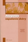 Atopowe zapalenie skóry. Poradnik lekarza praktyka - zdjęcie