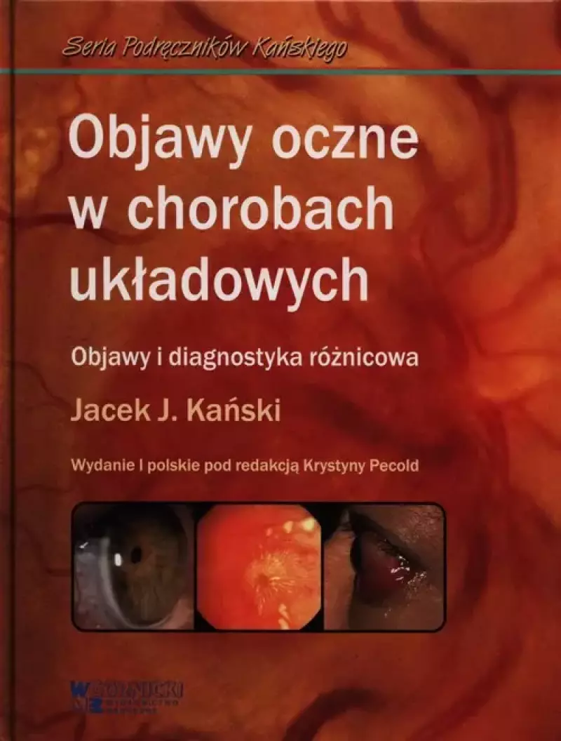 Objawy oczne w chorobach układowych Objawy oczne w chorobach układowych
