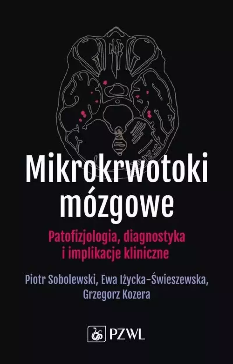 Mikrokrwotoki mózgowe Mikrokrwotoki mózgowe