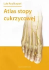 Atlas stopy cukrzycowej - zdjęcie