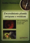 Zwyrodnienie plamki związane z wiekiem - zdjęcie