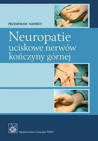 Neuropatie uciskowe nerwów kończyny górnej - Książki