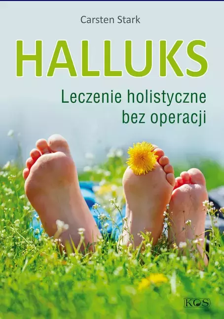 Halluks. Leczenie holistyczne bez operacji - Książki