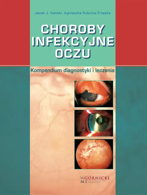 Choroby infekcyjne oczu - Książki
