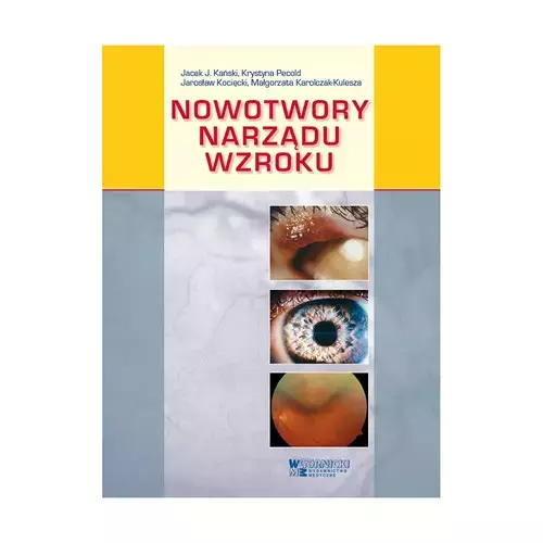 Nowotwory narządu wzroku - Książki