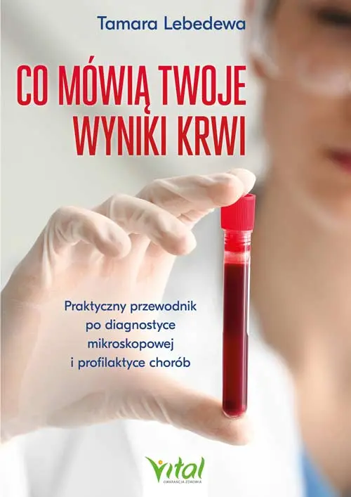 Co mówią twoje wyniki krwi. Praktyczny przewodnik po diagnostyce mikroskopowej i profilaktyce chorób - Książki