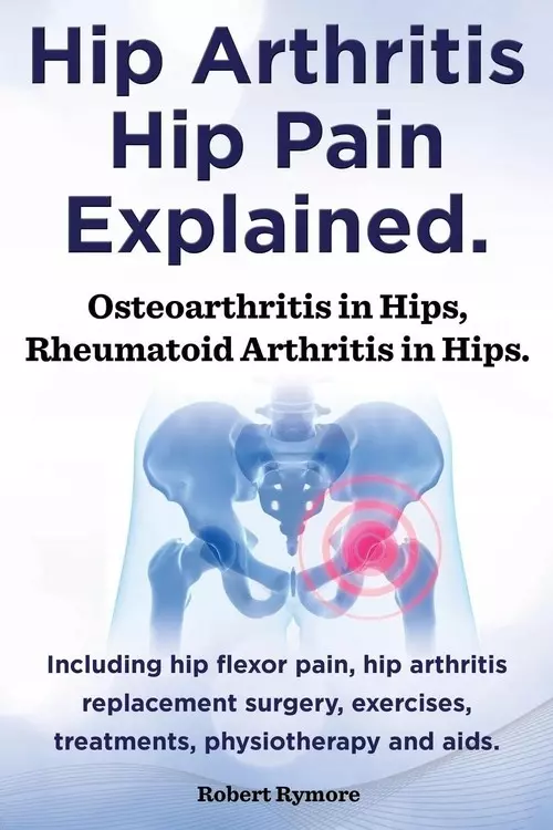 Hip Arthritis, Hip Pain Explained. Osteoarthritis in Hips, Rheumatoid Arthritis in Hips. Including Hip Arthritis Surgery, Hip Flexor Pain, Exercises, - Książki
