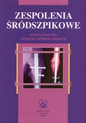Zespolenia śródszpikowe - Książki