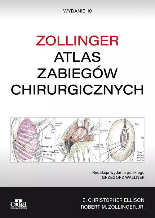 Atlas zabiegów chirurgicznych. Zollinger - Książki