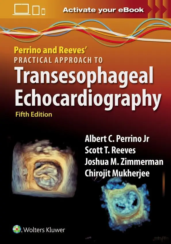 Perrino and Reeves' Practical Approach to Transesophageal Echocardiography - Książki