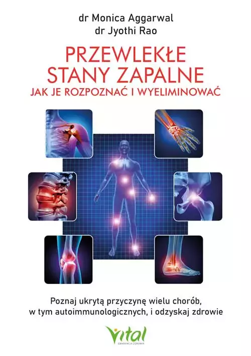 Przewlekłe stany zapalne - jak je rozpoznać i wyeliminować. Poznaj ukrytą przyczynę wielu chorób, w tym autoimmunologicznych, i odzyskaj zdrowie - Książki