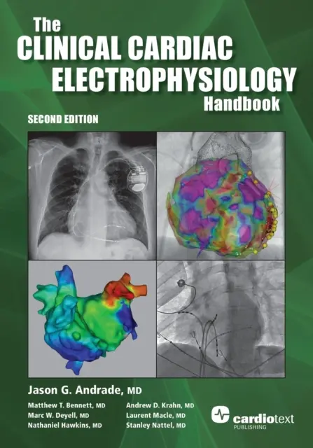 The Clinical Cardiac Electrophysiology Handbook, Second Edition - Książki