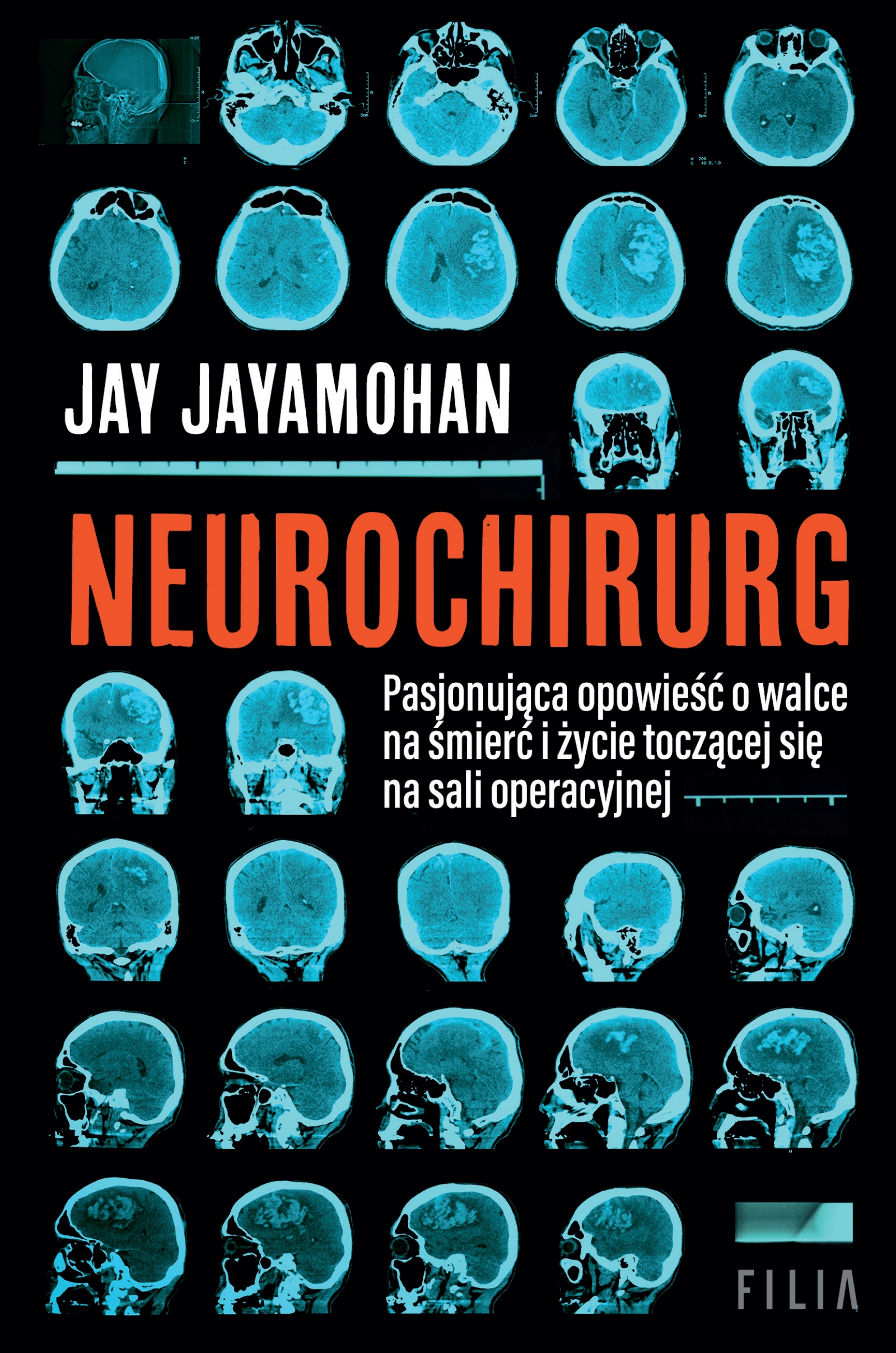 Neurochirurg - Książki
