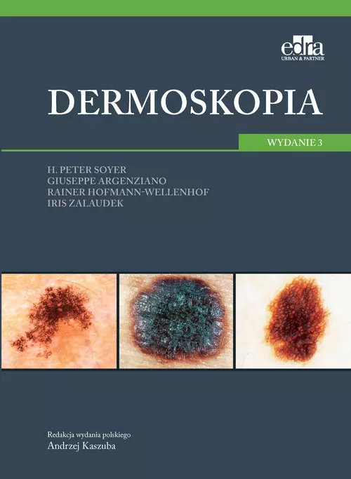 Dermoskopia, wydanie 3 - Książki