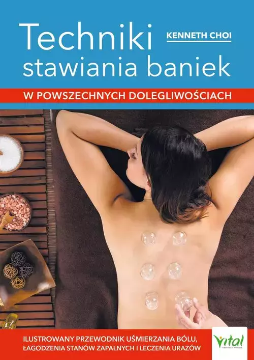 Techniki stawiania baniek - Książki